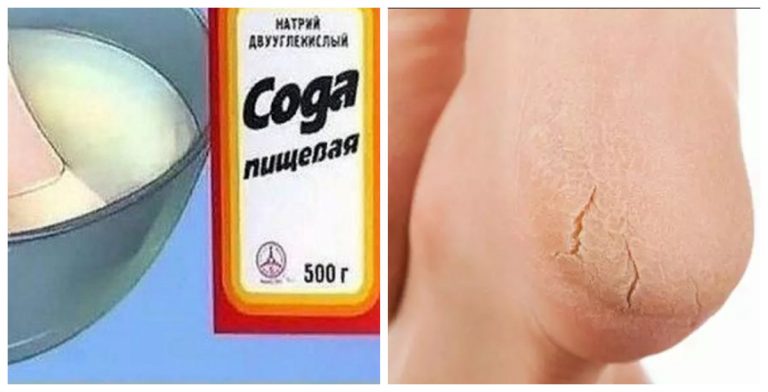 Vannochka dlya nih z sodoyu