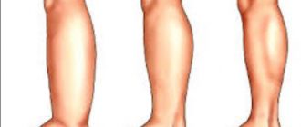 0f8d24c42a99437cdfd8d474f315fa2f