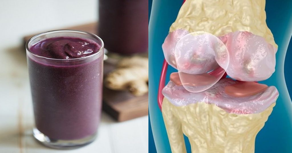 5 продуктів, які усунуть запалення суглобів і заспокоять болі. Дієвий рецепт