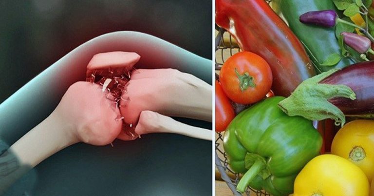 Якщо у вас артрит, то вам варто обмежити вживання цих продуктів! 9 Esly u vas artryt