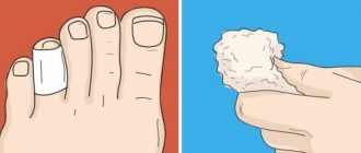 ЦЯ ДИВО МАЗЬ ДОПОМОЖЕ ПОЗБУТИСЬ МОЗОЛІВ І НАТОПТИШІВ БЕЗ ХІМІЇ І БoЛЮЧИХ ПРОЦЕДУР |