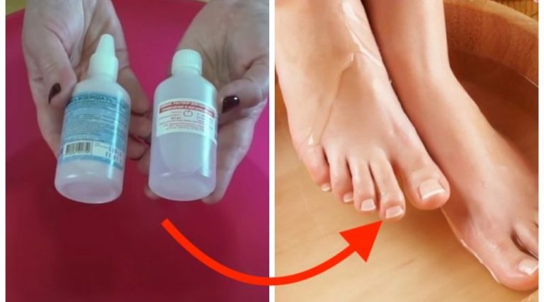 idealnye pjatki bez salonnogo pedikjura i rashoda deneg legko 22fea1d