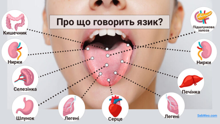 Якщо під час чищення зубів ви бачите на своєму язику щось дивне – не ігноруйте! Це може бути небезпечно… 9 2fe310b5a79c6f8ec14e78f270770b51