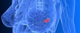 72ddcc5a03a0b085692d4d35ffa36ba5