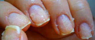 8e7f0e789f6f0e021644a6ab99481dca