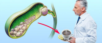 b3df2ff5b77f4ee41d9b0b8b30f77c86