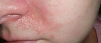 a616ceac76857f7372a625ea4e662d69