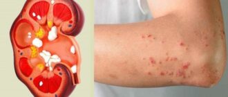 a92643c121cd657393538c9e8828d9dc